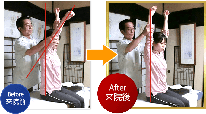 施術例